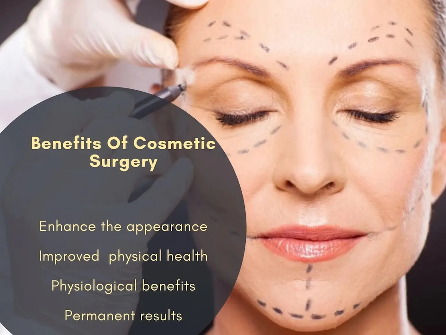 Benefits of Cosmetic Surgery