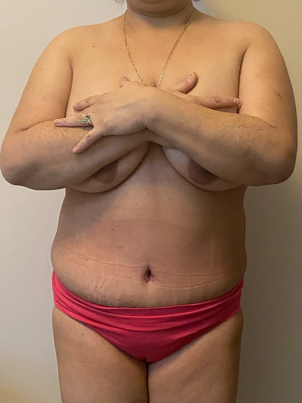 Procedure case #7713