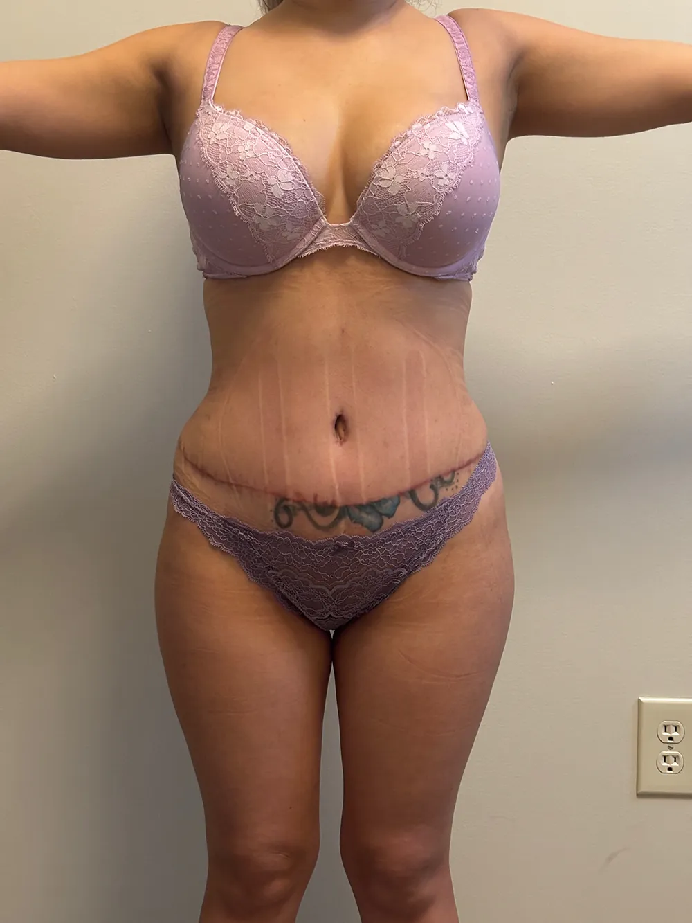 Procedure case #7723