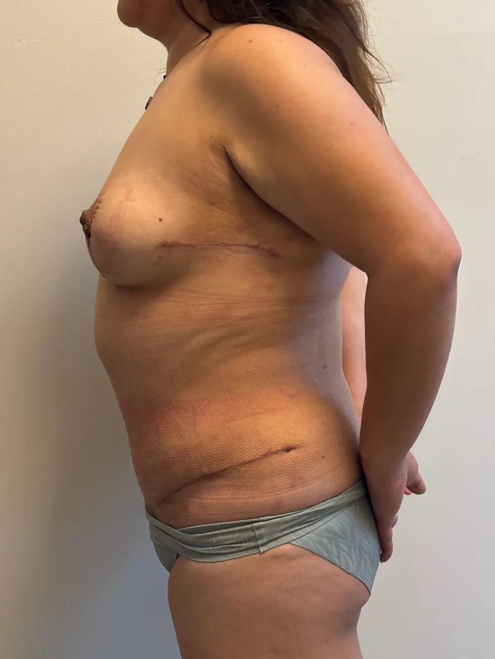 Procedure case #7684