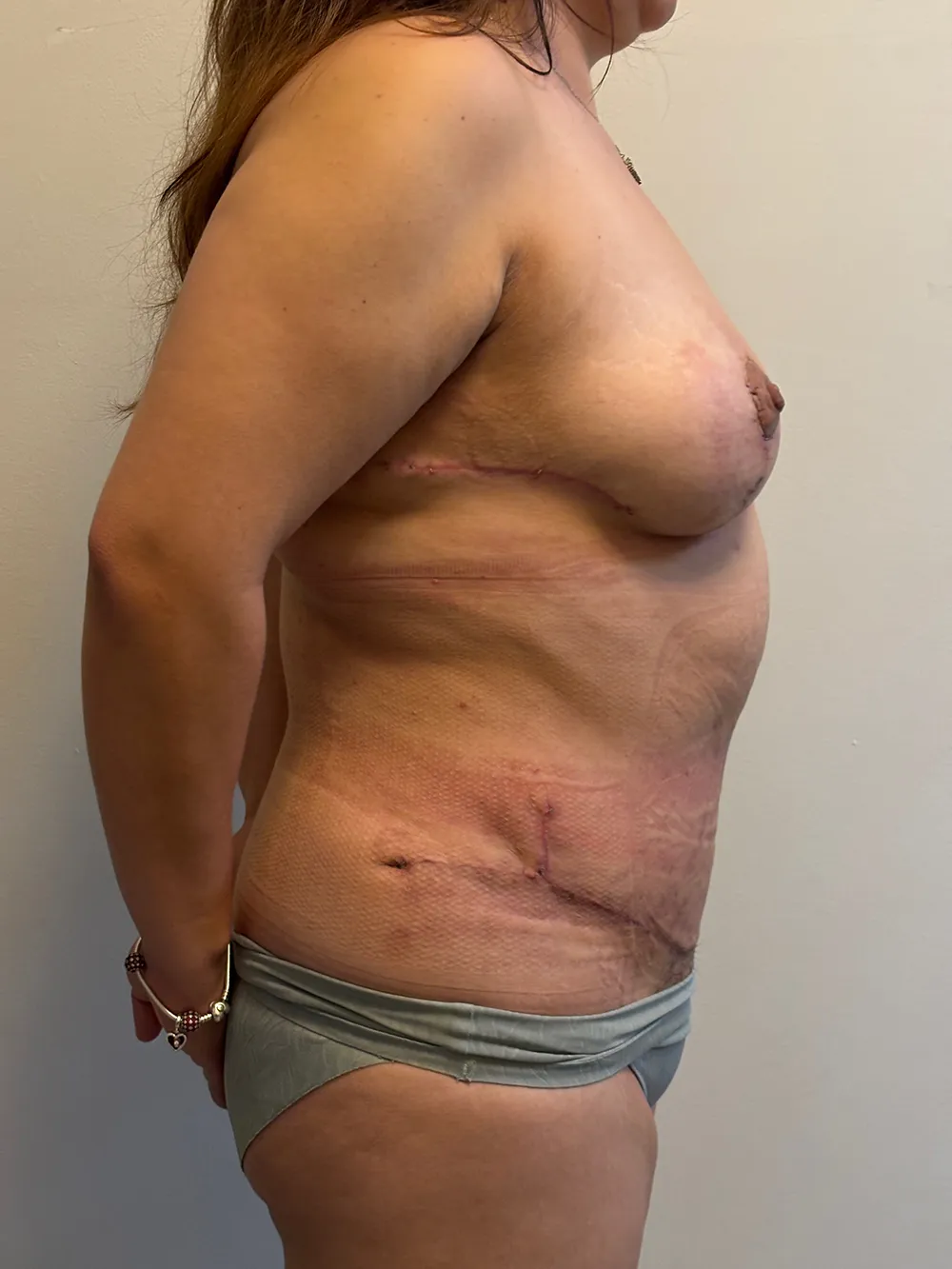 Procedure case #7684