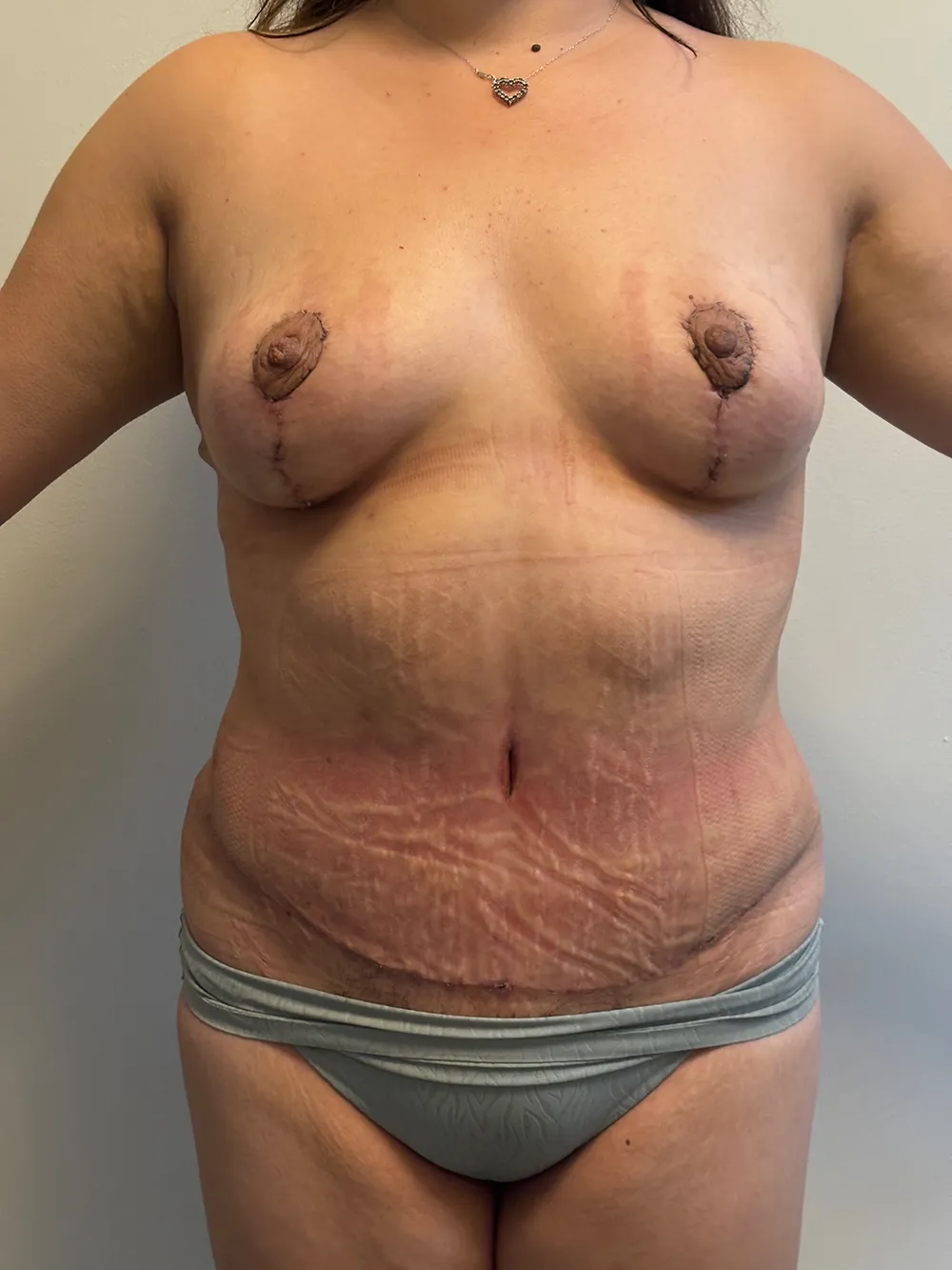 Procedure case #7684